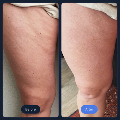 body_slimming_4